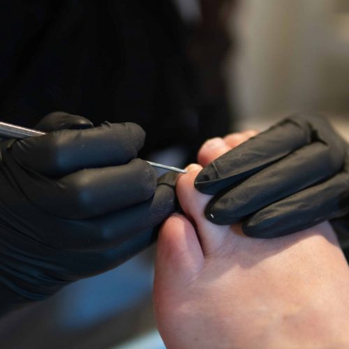 Pedicure-en-medische-voet-behandeling- Pedicure-en-medische-voet-behandeling-